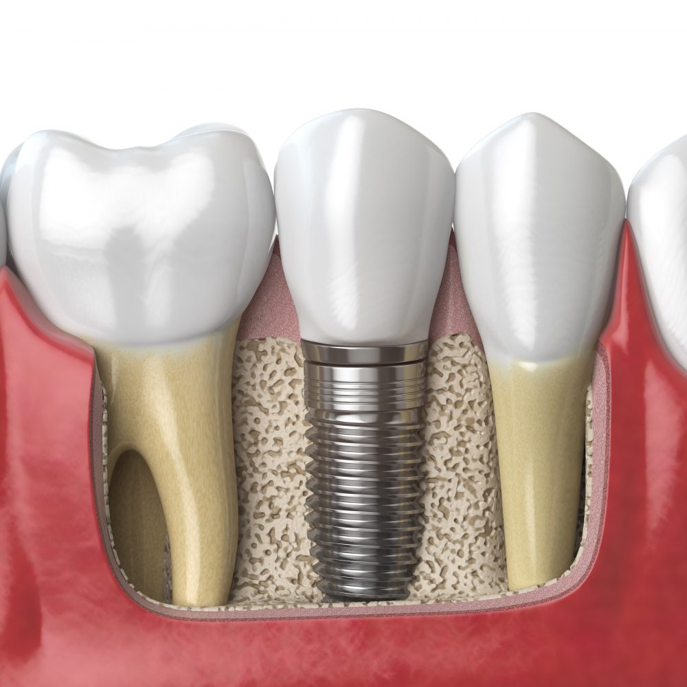 North Pointe Dental